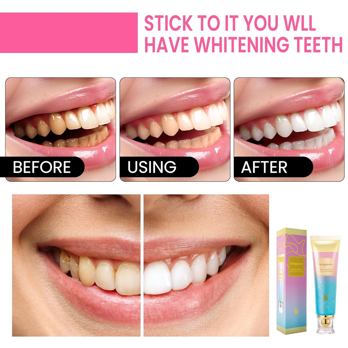 Pack BodyAccel Niacinamide Whitening Toothpaste, Triple Whitening Niacinamide Toothpaste, Brightens and Whitens Teeth, Natural Gentle, Fresh Breath