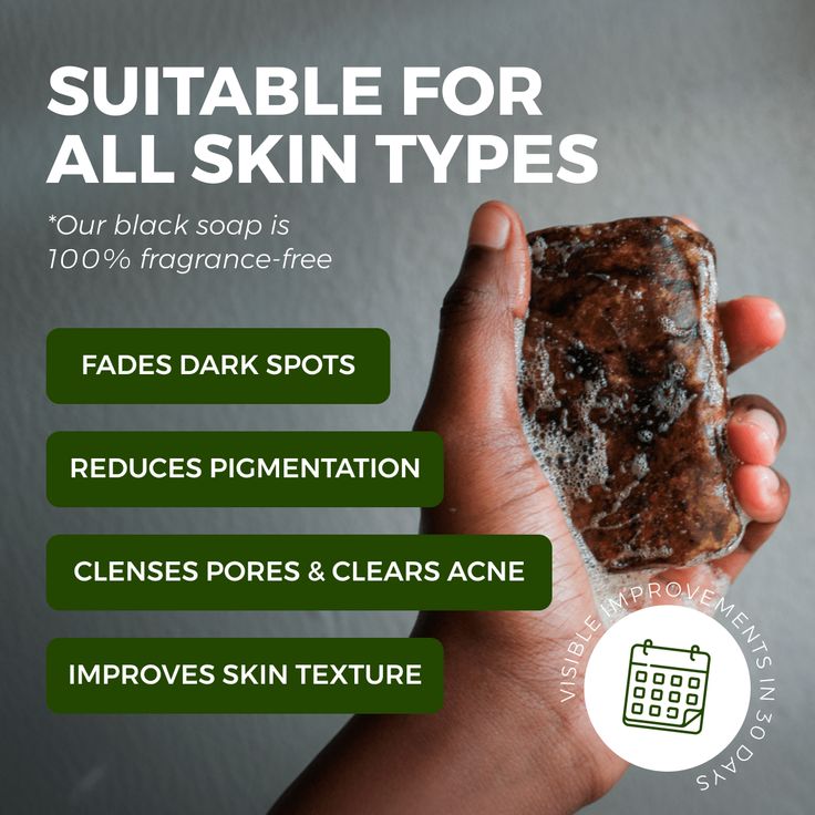 Raw African Black Soap (200 Grams) from Ghana for Dark Spots, Acne Marks & Uneven Skin Tone | Authentic Handmade Natural Soap for Face & Body | Deep Cleansing Moisturizing Bar